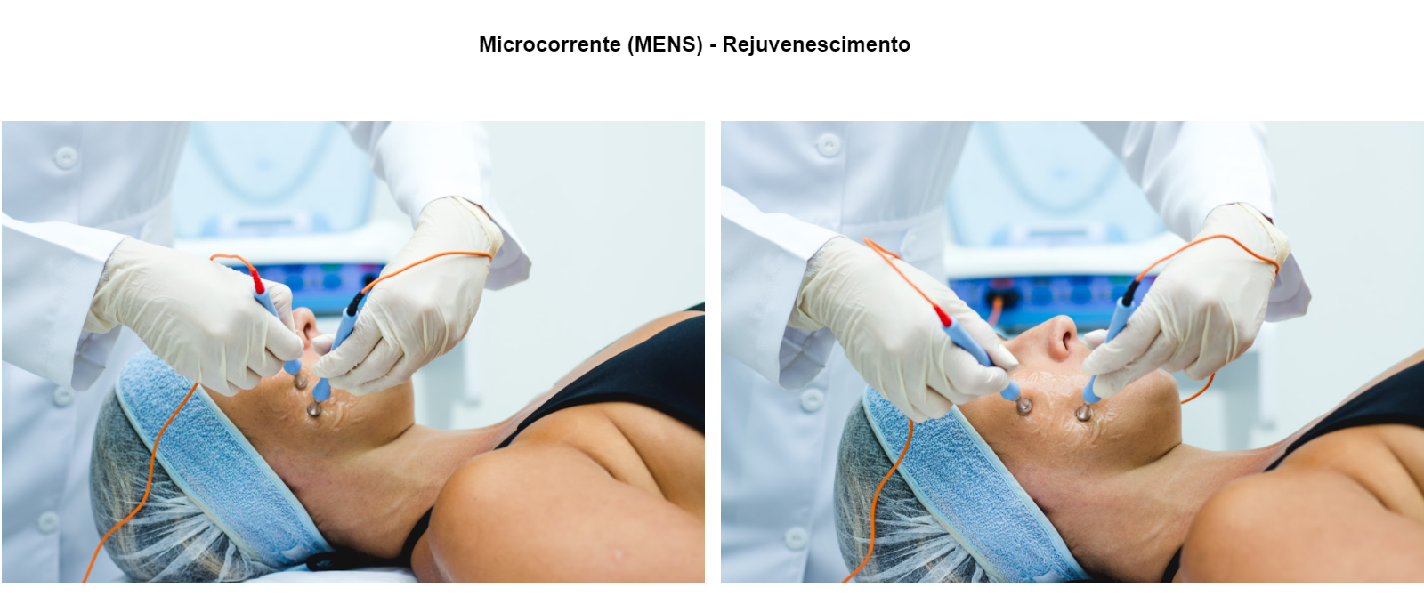 Microcorrente (MENS) - Rejuvenescimento