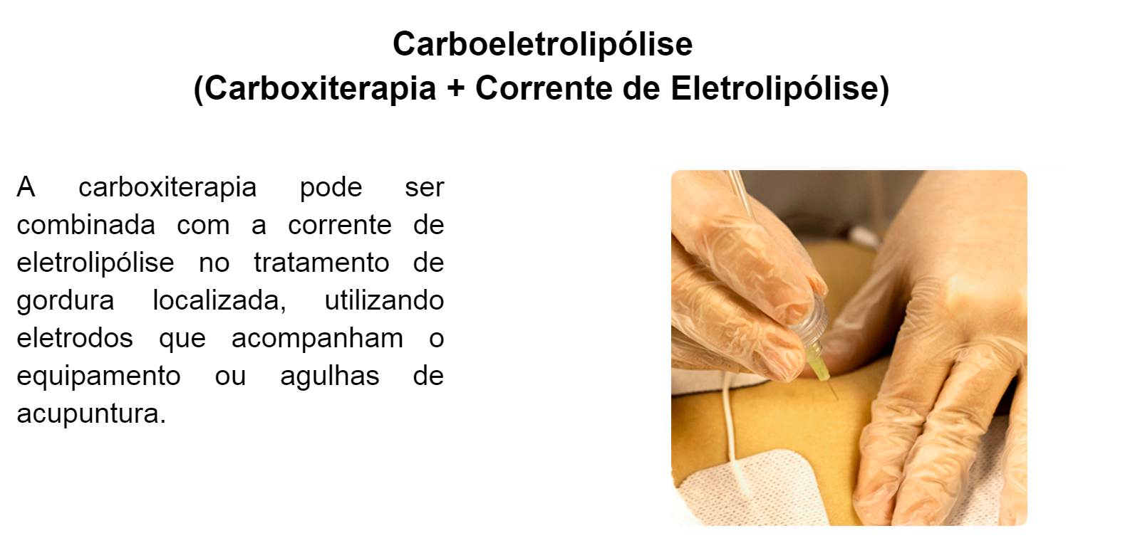 Carboeletrolipólise