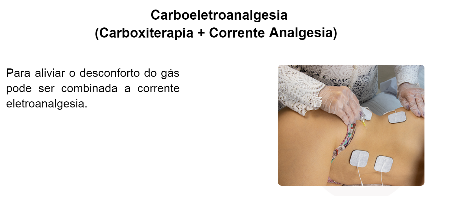 Carboeletroanalgesia